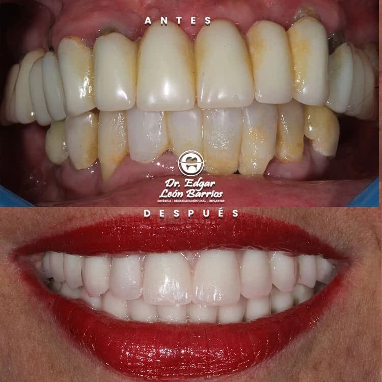 Transformación dental 7